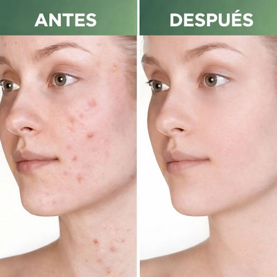 MASCARILLA EXFOLIANTE DE TÉ VERDE - SKINVERDE